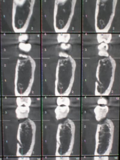 Cawclv715kbnkadplmdo - Eugenol