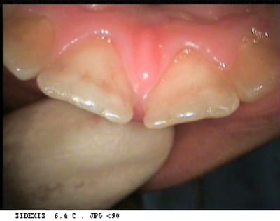 Cent bis xvyrxd - Eugenol