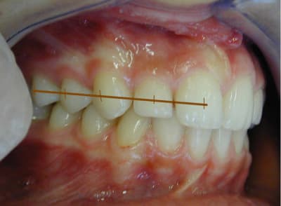 Centre f8hufl - Eugenol