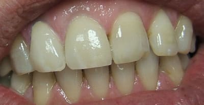 Centrqle0018 semrk3 - Eugenol