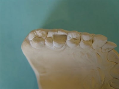 Cerec15 kd4c3m - Eugenol