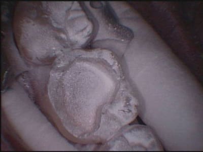 Cerec4 idk2de - Eugenol