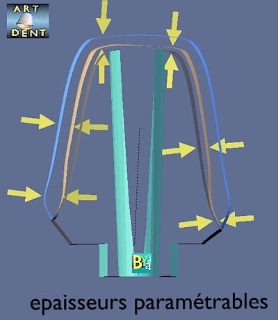 Chape conception enfoll - Eugenol