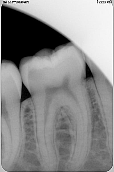 Cli6zuk60pvvw9l8332gckfssbt5 - Eugenol