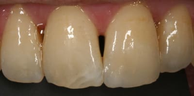 Compo ant kpz32e - Eugenol