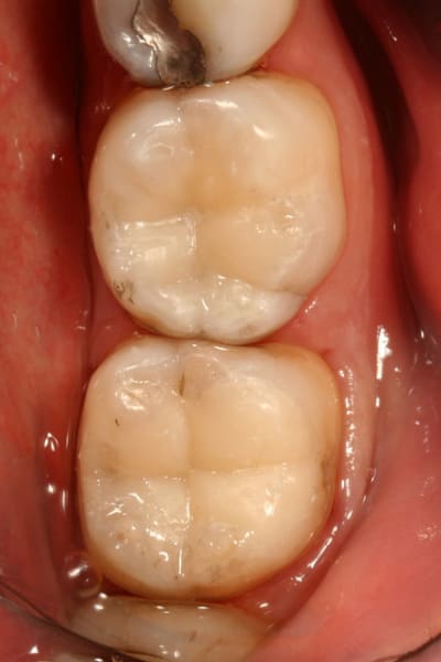 Compo finit xyxnna - Eugenol