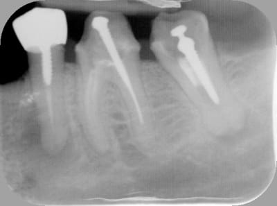 Cones xpaqhp - Eugenol