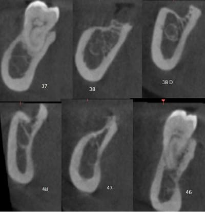 Coupe post ulae1w - Eugenol