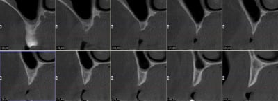 Coupes fqdyde - Eugenol