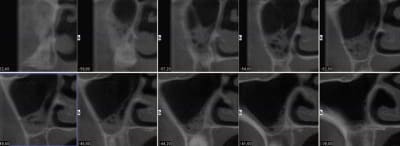 Coupes z77bkp - Eugenol