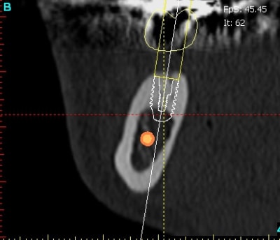 Cr ve cross section1 nqmrjl - Eugenol