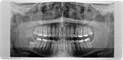 Cysta 1 x0jwjz - Eugenol