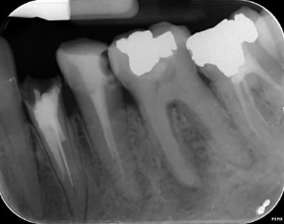 D2i6adrgol98kmgq9kj0 - Eugenol