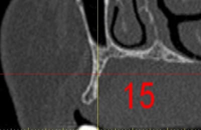 Dar15 qsiu0n - Eugenol