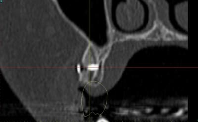Dar15 zvi82y - Eugenol