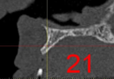 Dar21 aqnhur - Eugenol