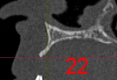 Dar22 tjxh0a - Eugenol