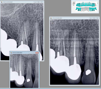 Dbhgtc0a3fwfvljy7cmg - Eugenol