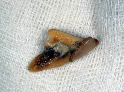 Dent02 jykxwe - Eugenol