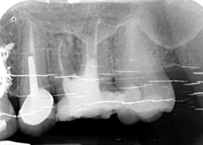 Dent 2 quopnx - Eugenol