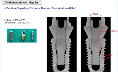 Dentium gap test yvayqt - Eugenol