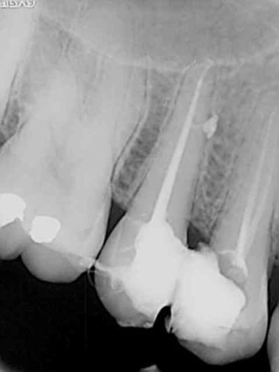 Dias alexis fxrxoi - Eugenol