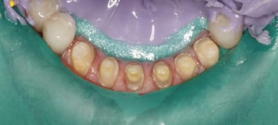 Digue bas zeulxr - Eugenol