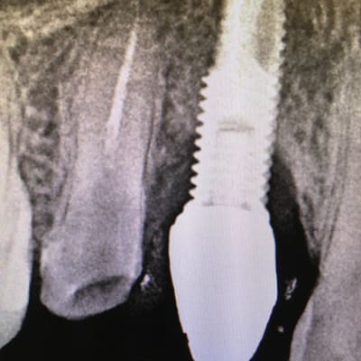 Dinejumu0obebf9c5r3x - Eugenol