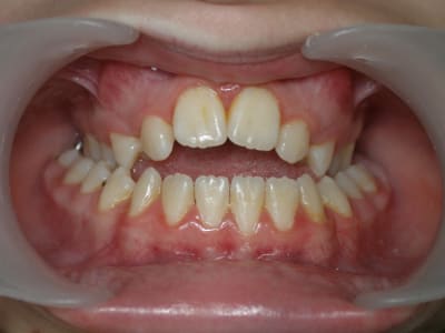Disj 1 nkafjp - Eugenol