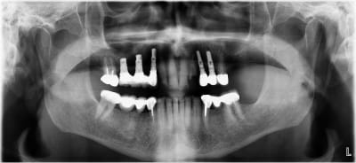 Dou nrviyj - Eugenol