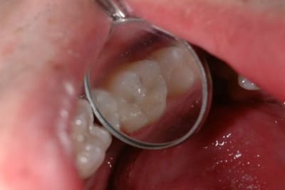 Dsc 2671 hkts8h - Eugenol
