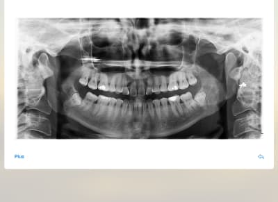 Duuzhxjexa6g9png45r0 - Eugenol