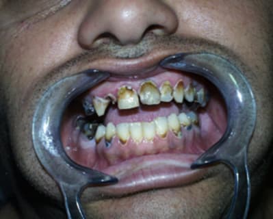 Dvd1 dis2ff - Eugenol