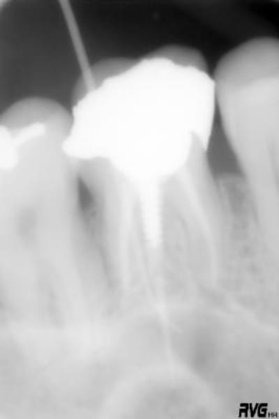 Ember dm4sql - Eugenol