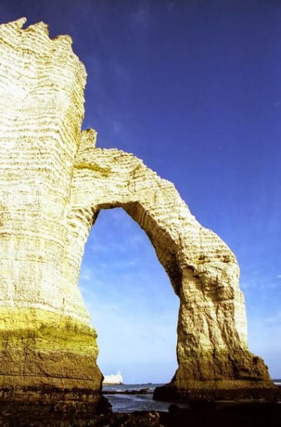 Embrasure q8pequ - Eugenol