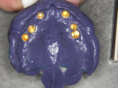 Empreinte avec chassis et galvanos jy1ktp - Eugenol