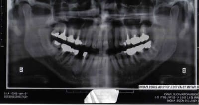 Eric brr5u5 - Eugenol