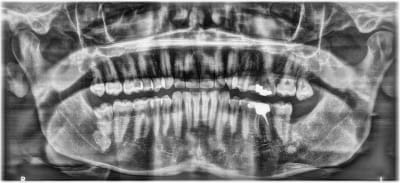 Erpmf09rsahcob5wfbab - Eugenol