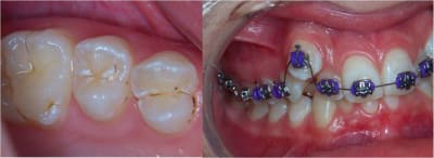 Exemple 2 nu1lzj - Eugenol