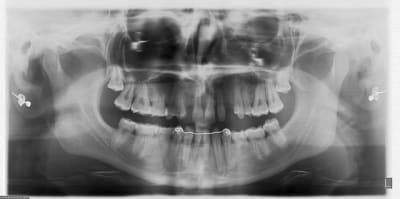 Exemple ebeela - Eugenol