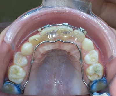 F44aay4s5kgk9g2avmfqbj016ptr - Eugenol