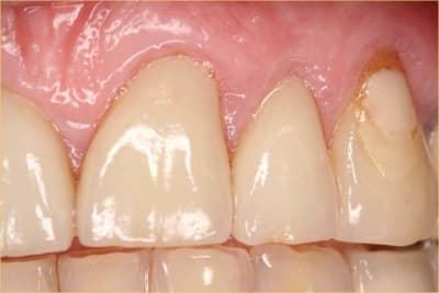 Facettttte msv4we - Eugenol