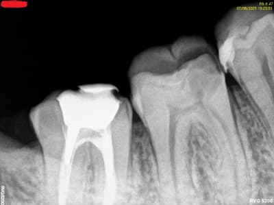 Fea7jimingnzpmn0z3a271gx2myi - Eugenol