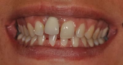 Fih4adatnhyn1yerdcd2 - Eugenol