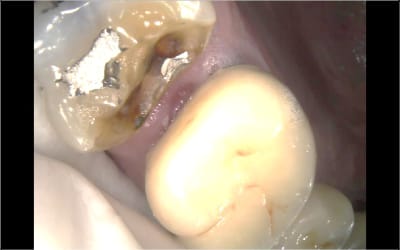 Fil1 o23suu - Eugenol