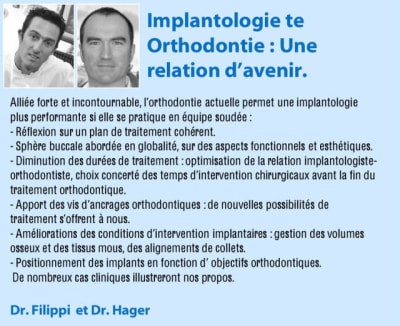 Filppi rijigy - Eugenol