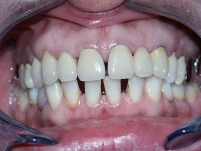 Fin lh2qzn - Eugenol