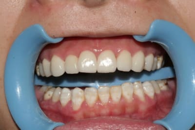 Final1 udts8w - Eugenol