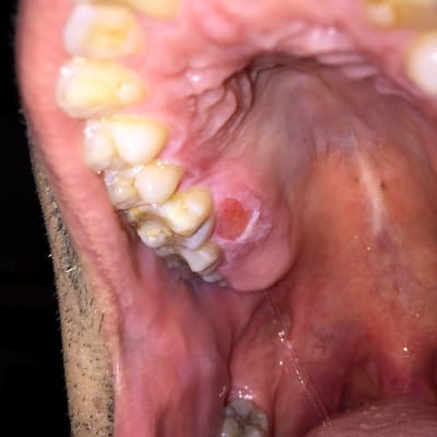 Fiymj3jupvvnvhom0wfo - Eugenol