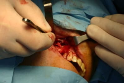 Flou iowylj - Eugenol